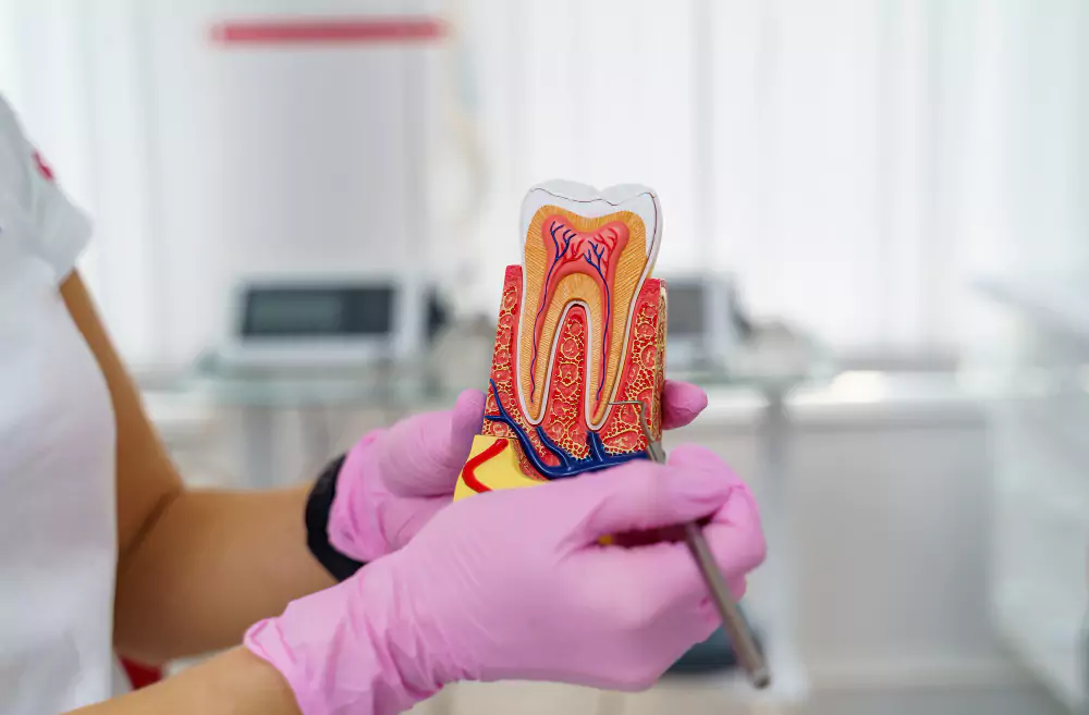 Root Canal Treatment